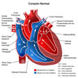 Estenosis aortica